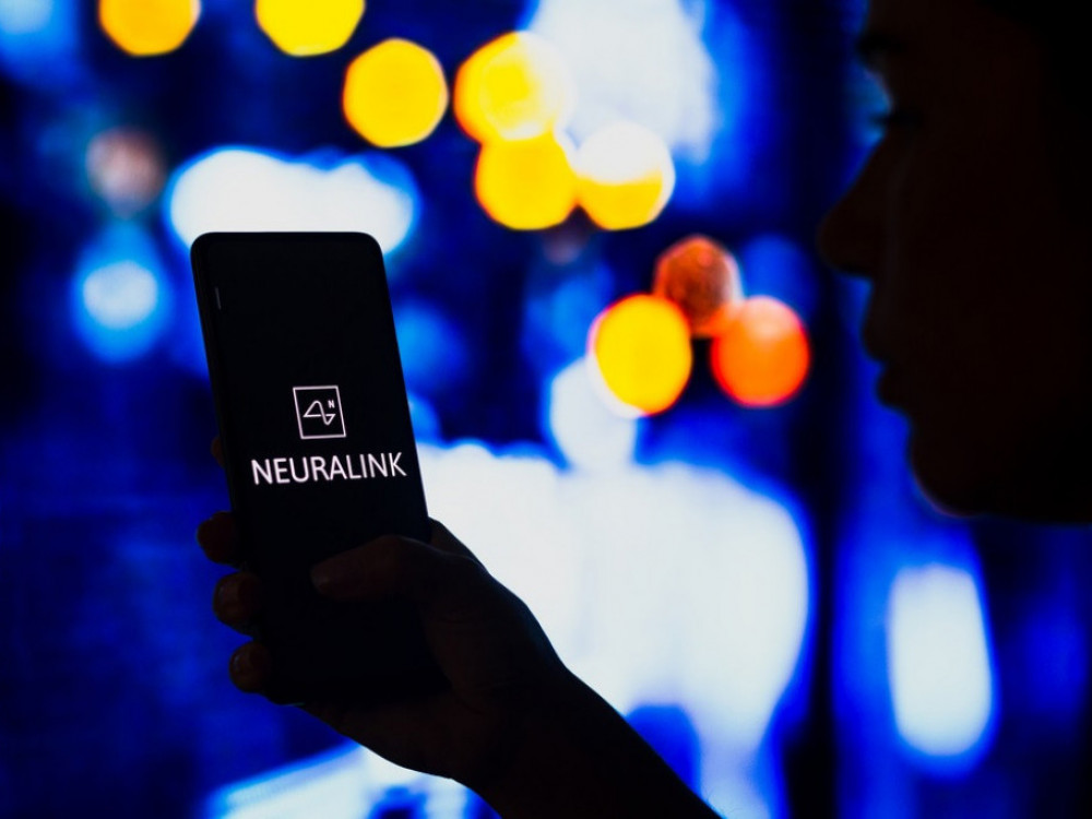 „Неуралинк“ на Маск за шест месеци ќе почне да вградува импланти кај луѓе