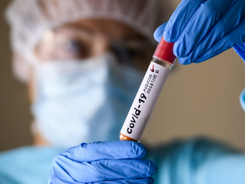 Големи се шансите за нова пандемија во следните десет години