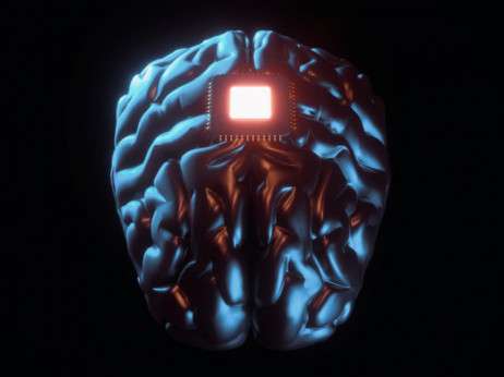 Маск објави дека неговиот стартап вградил мозочен имплант кај човек
